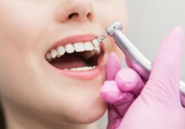 Eine Zahnzusatzversicherung kann oftmals sinnvoll sein. Foto chibelek via Twenty20