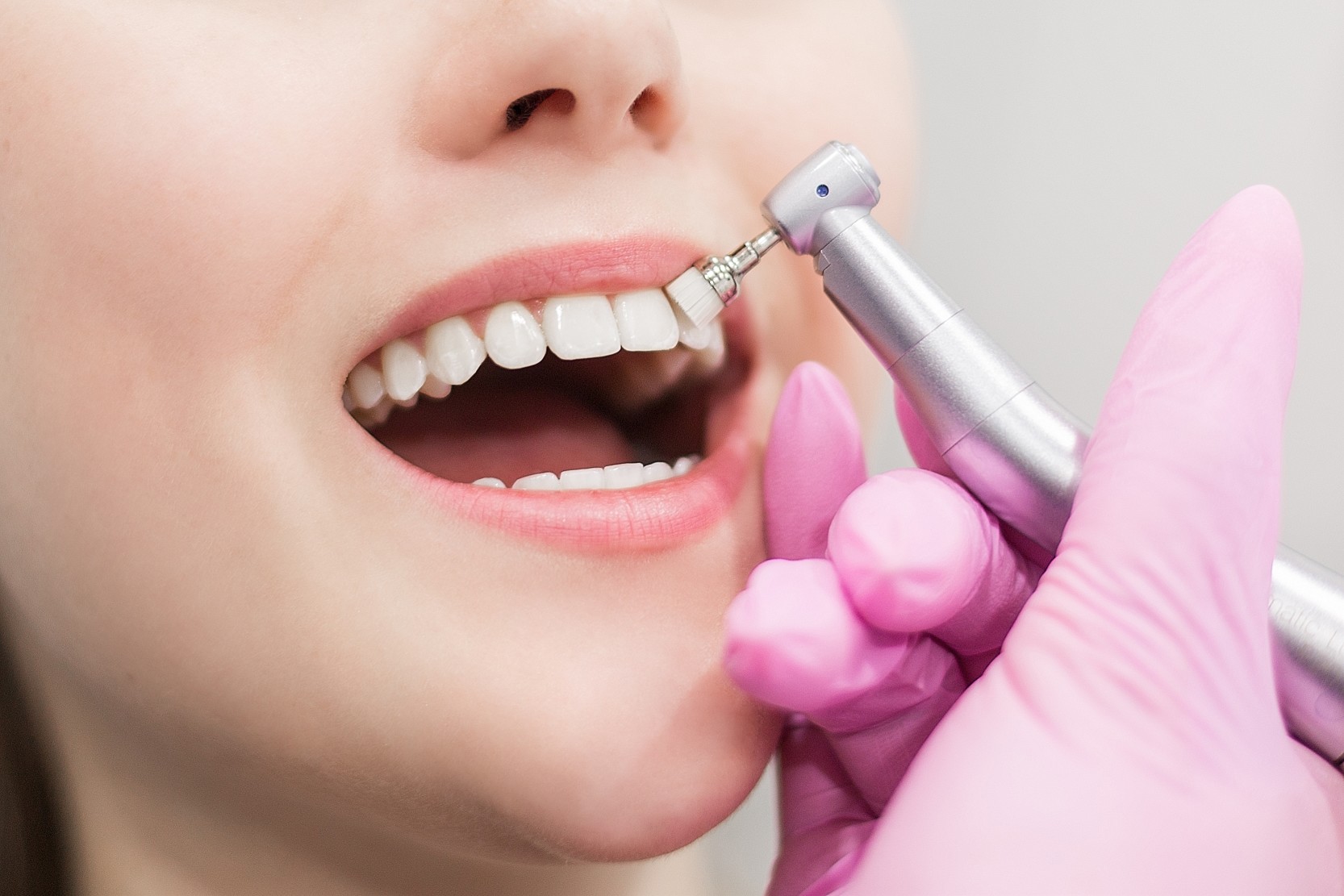 Eine Zahnzusatzversicherung kann oftmals sinnvoll sein. Foto chibelek via Twenty20